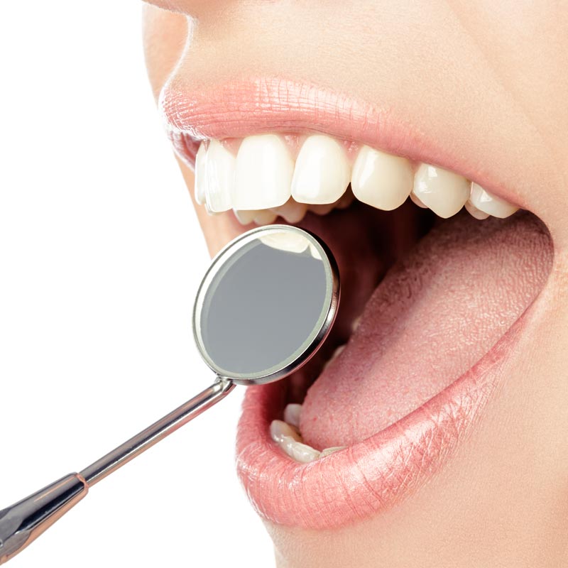 Mouth Mirror Ø 22Mm Stainless