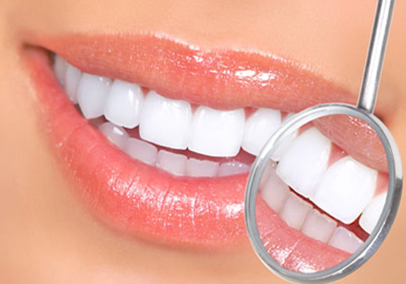 Zahnreiniger & Dentalspiegel mit oder ohne Vergrößerung SET