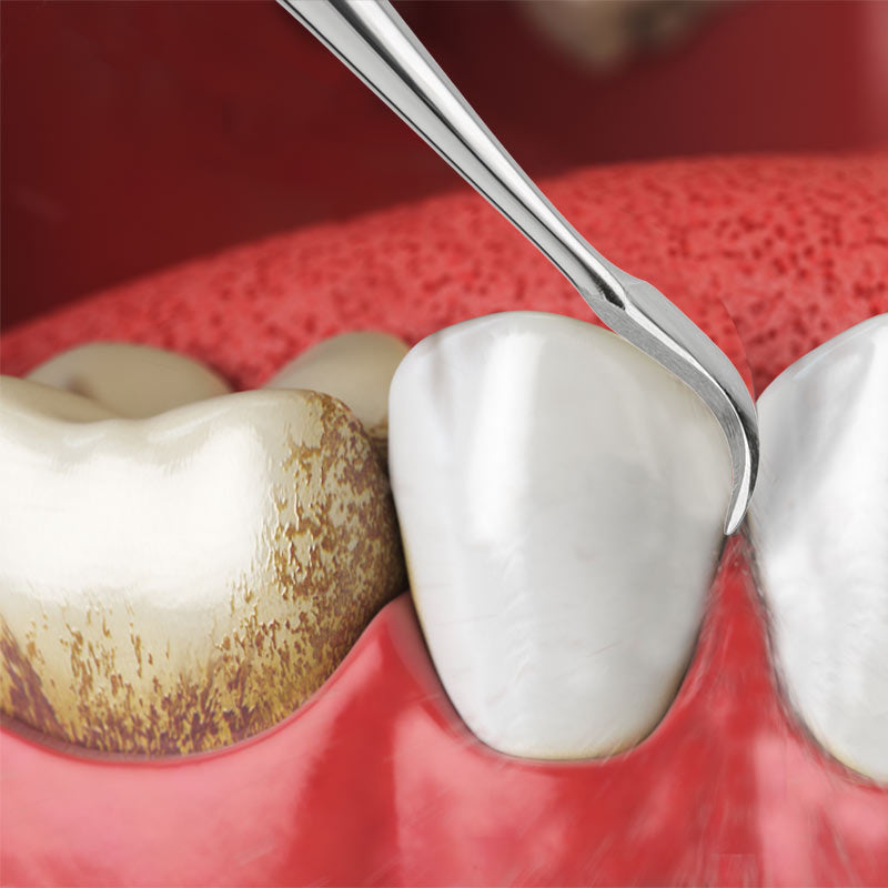 Zahnreiniger & Dentalspiegel mit oder ohne Vergrößerung SET