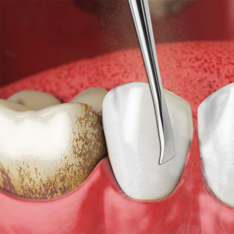Zahnreiniger & Dentalspiegel mit oder ohne Vergrößerung SET