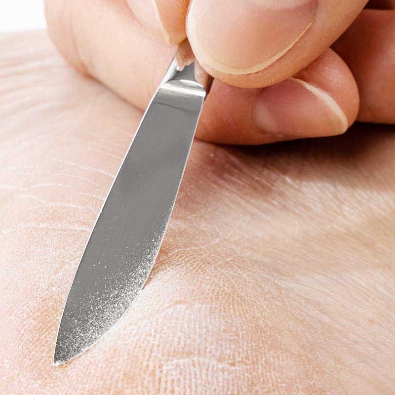 Scalpel Stainless
