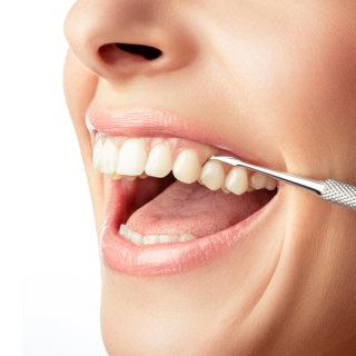 REMOS® Zahnradierer mit Zahnsteinentferner 11 cm Edelstahl