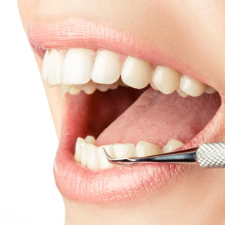 REMOS® Zahnradierer mit Zahnsteinentferner 11 cm Edelstahl