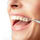 tooth discolouration eraser + plaque remover